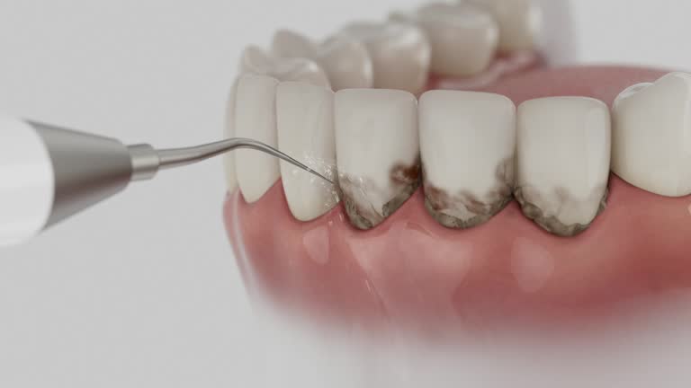 Reliable Dental contractor in Mount Horeb, WI by Smile Center Dentistry